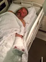 Bir Anlık Dikkatsizlik sonucu Parmaklarını Kesim Motoruna Kaptırdı.