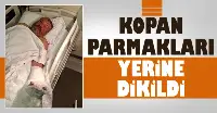 Bir Anlık Dikkatsizlik sonucu Parmaklarını Kesim Motoruna Kaptırdı.